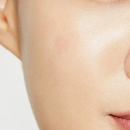 COSRX Clear Fit Master Patch - The Fairy Glow